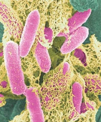 E-coli-in-color